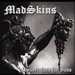 MadSkins : Louder Than the Gods